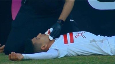 صور مؤلمة لإصابة نجم الزمالك.. شاهد