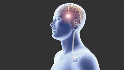 على طريقة اللمبي.. عالم يحذر من زرع الرقائق الإلكترونية في أجساد البشر