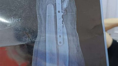 صحة الشرقية تقديم رعاية طبية نموذجية للمواطنين