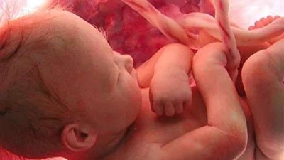 نجاح الأطقم الطبية بالمنوفية في إتمام عملية ولادة طفلين لأم مصابة بكورونا