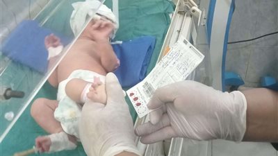 صحة الشرقية تفحص أكثر من ٢٦ ألف طفل للكشف المبكر عن الأمراض الوراثية