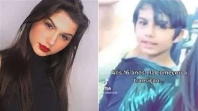 مفاجأة.. توأم يجري عملية تغيير الجنس في نفس الوقت