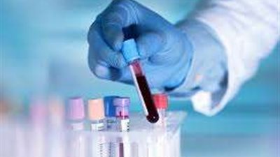 وصول أولى شحنات الأدوية المشتقة من البلازما المصرية من إسبانيا