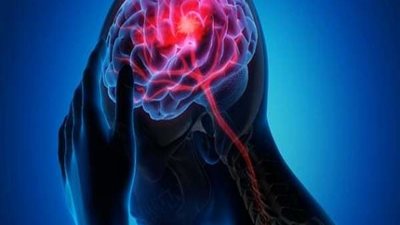 5 علامات خطيرة لجلطة دموية لا يمكن تجاهلها