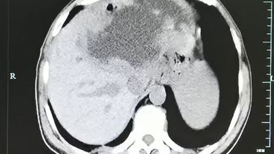 أعراض غير متوقعة تنذر بمرض خطير