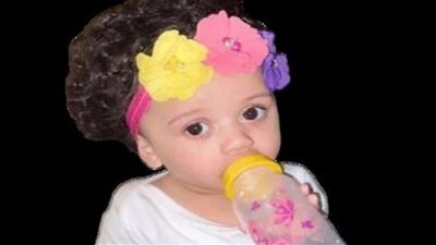 مصرع طفلة على يد كلب عائلتها الأليف.. صور