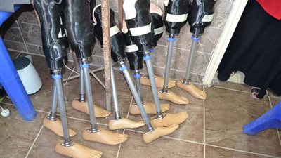 تسليم 31 جهاز تعويضي بقافلة طبية بنادي متحدي الإعاقة بدمنهور