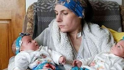 صدق أو لا تصدق.. أربعينية تضع توأمين رغم أمنتاعتها عن تناول الطعام