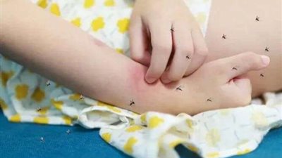 أصاب 200 شخص في ساعات.. مرض غريب يثير الذعر في قنا والصحة ترد