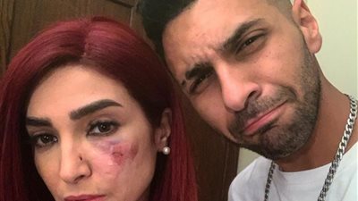 رغم الإصابة ... روجينا تستكمل تصوير مسلسل 