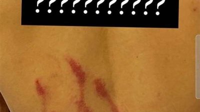 محمد شريف يكشف حجم إصابته بعد تدخل حارس صن داونز