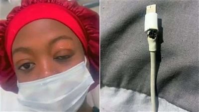 كارثة.. شاحن هاتف يسبب العمى لفتاة