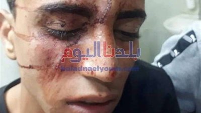 جهود مكثفة لضبط المتهم بأصابة شاب بسبب معاكسة فتاة فى الغربية.. (صورة)