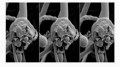 لماذا لم تطلق الصحة تحذيرا حول الفطر الأسود؟