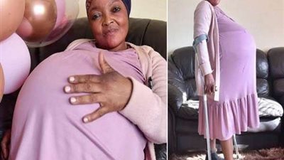 في الأسبوع الـ 29 من الحمل.. سيدة تنجب 10 توائم دفعة واحدة