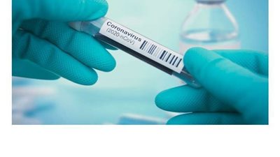 تسجل 2199 إصابة و77 وفاة بفيروس كورونا بـ إيطاليا