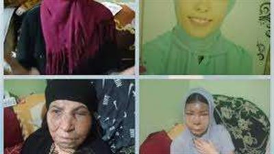 جهود مكثفة لضبط المتهم بإلقاء مياه نار على سيدة وابنتها بالقليوبية