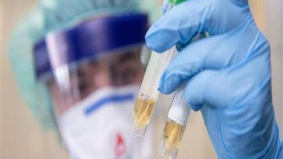 الدكتور علي اللبيدي يقود فريقًا أمريكيًا لاكتشاف مفاجأة بشأن لقاح كورونا