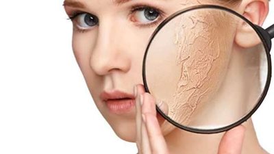 كيف تعتني ببشرتك الجافة في فصل الصيف؟