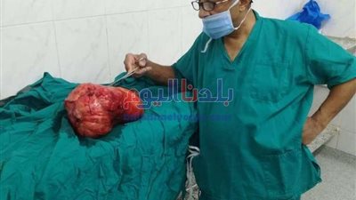 استئصال 27 ورم ليفى من رحم فتاة فى دسوق بكفر الشيخ