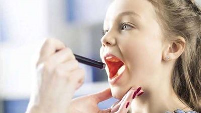 ما علاقة استئصال اللوزتين بفيروس كورونا؟.. طبيبة روسية تجيب