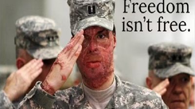 ضابط أمريكي مصاب بحروق بالغة في أفغانستان يهاجم تويتر لهذا السبب