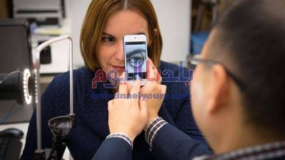 صورة سيلفى تكشف عن فقر الدم لدى الإنسان .. تفاصيل