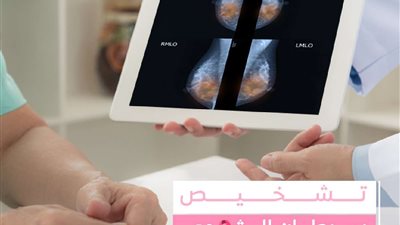 هيئة الدواء تعلن عن كيفية تشخيص سرطان الثدي