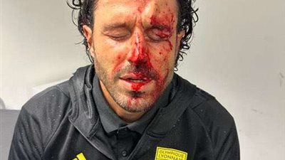 الدوري الفرنسي.. إلغاء مباراة ليون ومارسيليا بعد إصابات بالغة