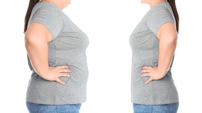 استشاري جراحة: التكميم الدقيق هدفه إخفاء الجروح وتقليل المضاعفات