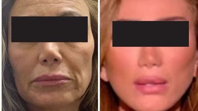 ريهام سعيد تتهم طبيب تجميل بتشويه وجهها (صور)