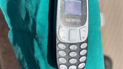 لأول مرة بالمنوفية.. استخراج هاتف محمول من معدة مريض