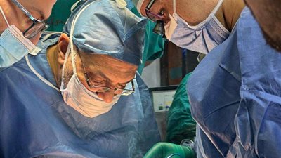 فريق مستشفى أطفال جامعة أسيوط ينجح فى فصل توأم ملتصق