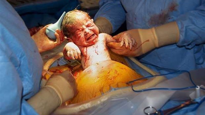 صورة ارشيفيه