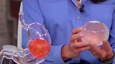 تكلفة عملية بالون المعدة في تركيا-عيادة مديكسي