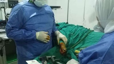 صحة المنوفية : أول جراحة عظام بمستشفى زاوية الناعورة بعد توقف عام كامل ( صور )