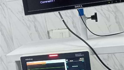 بعد توقف ٤ شهور ....استئناف العمل بوحدة مناظير الجهاز الهضمي بمستشفى كفر الدوار العام