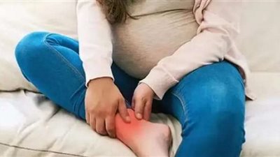 تورّم القدمين أثناء الحمل.. دليل شامل للتعامل مع الأعراض والعناية بصحتك