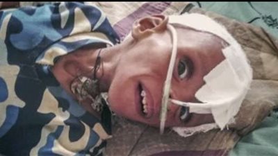 تحذيرات من كارثة غذائية وارتفاع معدلات سوء التغذية في نيجيريا