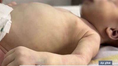 غزة.. أطفال يموتون بردًا وسط صمت العالم