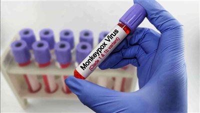 منظمة الصحة العالمية تصف الوضع الوبائي لجُدري القرود 