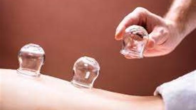 الفوائد الصحية للحجامة ودورها في تعزيز الشفاء الطبيعي