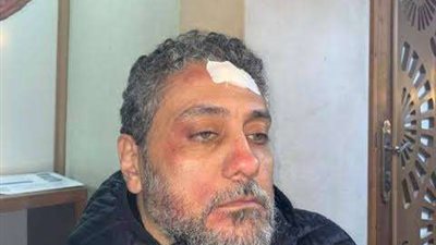 تامر فرج يتعرض لإصابة أثناء تصوير أحد مشاهده بـ