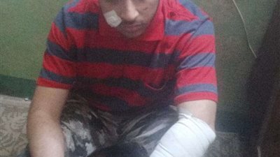 شاب من ذوي الهمم يتعرض لاعتداء على يد عمه وأبناء عمومته في كرداسة.. صور