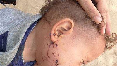 الكلاب الضالة تغزو ضواحي الإسماعيلية.. وظهورها يثير رعب الأهالي