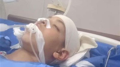اعتداء ثلاثة شباب على طفل بكفرالشيخ ووالده عايز حق ابنى