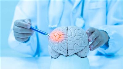 3 إشارات لا تتجاهلها.. علامات مبكرة قد تنقذ حياتك من السكتة الدماغية