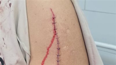 تفاصيل تعدي بلطجي «الحتة» على موظف أثناء خروجه من المسجد في حلوان