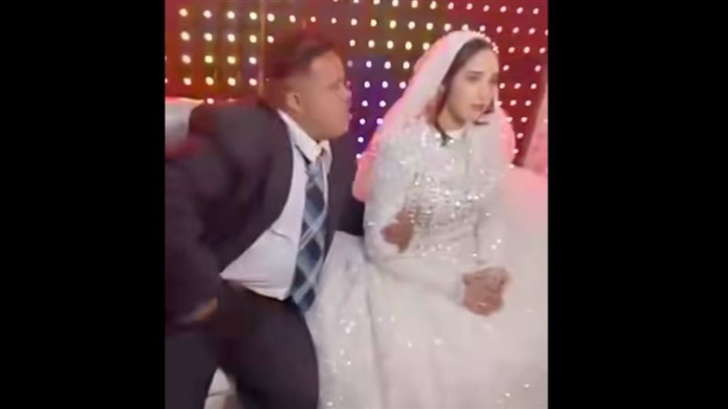 عريس متلازمة داون