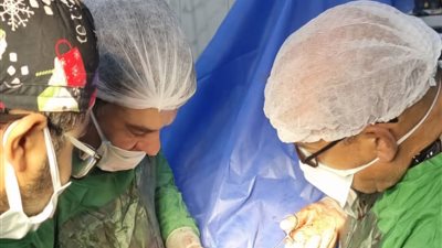 نجاح طبي جديد بمستشفيات المنوفية.. استئصال 27 ورمًا ليفيًا من رحم سيدة